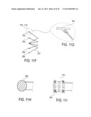 METHODS AND DEVICES FOR DEPLOYMENT INTO A LUMEN diagram and image