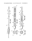 METHODS AND DEVICES FOR DEPLOYMENT INTO A LUMEN diagram and image