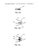 METHODS AND DEVICES FOR DEPLOYMENT INTO A LUMEN diagram and image