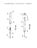 METHODS AND DEVICES FOR DEPLOYMENT INTO A LUMEN diagram and image