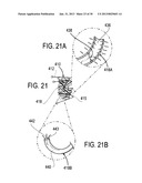 METHODS AND DEVICES FOR DEPLOYMENT INTO A LUMEN diagram and image