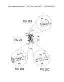 METHODS AND DEVICES FOR DEPLOYMENT INTO A LUMEN diagram and image