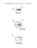 METHODS AND DEVICES FOR DEPLOYMENT INTO A LUMEN diagram and image