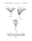 VAGINAL PESSARY diagram and image