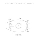 Conformable Therapeutic Shield for Vision and Pain diagram and image