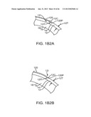 Conformable Therapeutic Shield for Vision and Pain diagram and image