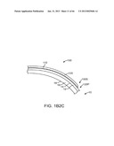 Conformable Therapeutic Shield for Vision and Pain diagram and image