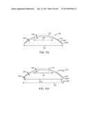 Conformable Therapeutic Shield for Vision and Pain diagram and image