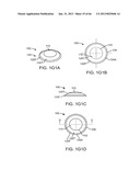 Conformable Therapeutic Shield for Vision and Pain diagram and image