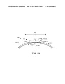 Conformable Therapeutic Shield for Vision and Pain diagram and image