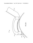 Conformable Therapeutic Shield for Vision and Pain diagram and image