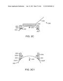 Conformable Therapeutic Shield for Vision and Pain diagram and image