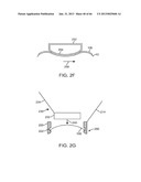 Conformable Therapeutic Shield for Vision and Pain diagram and image