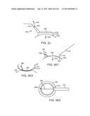 Conformable Therapeutic Shield for Vision and Pain diagram and image