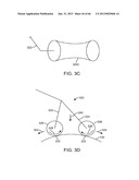 Conformable Therapeutic Shield for Vision and Pain diagram and image