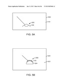 Conformable Therapeutic Shield for Vision and Pain diagram and image