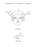 Conformable Therapeutic Shield for Vision and Pain diagram and image