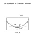 Conformable Therapeutic Shield for Vision and Pain diagram and image