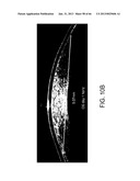 Conformable Therapeutic Shield for Vision and Pain diagram and image