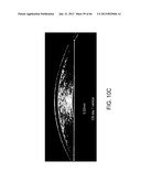 Conformable Therapeutic Shield for Vision and Pain diagram and image