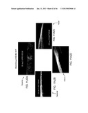 Conformable Therapeutic Shield for Vision and Pain diagram and image