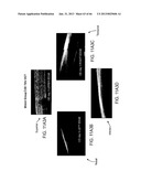 Conformable Therapeutic Shield for Vision and Pain diagram and image