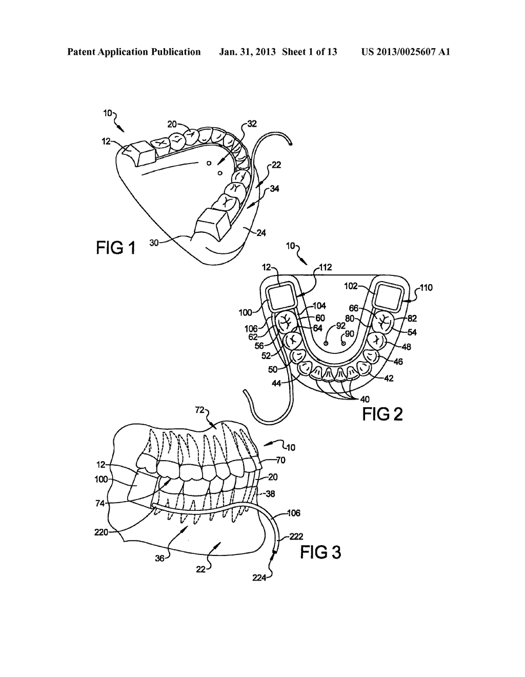 SYSTEM AND METHOD FOR SALIVA REPLENISHMENT AND CONTROL - diagram, schematic, and image 02