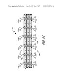 BOND AND STITCH REPAIR FOR DELAMINATED COMPOSITE diagram and image