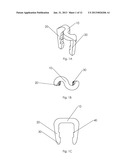 BONE STAPLE, INSTRUMENT AND METHOD OF USE AND MANUFACTURING diagram and image