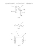 BONE STAPLE, INSTRUMENT AND METHOD OF USE AND MANUFACTURING diagram and image