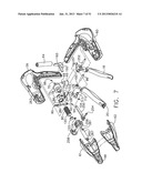 SURGICAL INSTRUMENT diagram and image