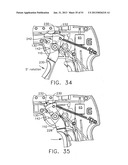 SURGICAL INSTRUMENT diagram and image