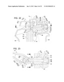 Systems and Methods for Dispensing Texture Material Using Dual Flow     Adjustment diagram and image