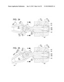 Systems and Methods for Dispensing Texture Material Using Dual Flow     Adjustment diagram and image