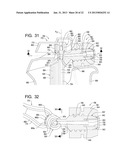 Systems and Methods for Dispensing Texture Material Using Dual Flow     Adjustment diagram and image