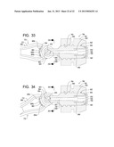 Systems and Methods for Dispensing Texture Material Using Dual Flow     Adjustment diagram and image