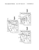 AIR BAG WITH VARIABLE VENTING diagram and image