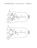 AIR BAG WITH VARIABLE VENTING diagram and image