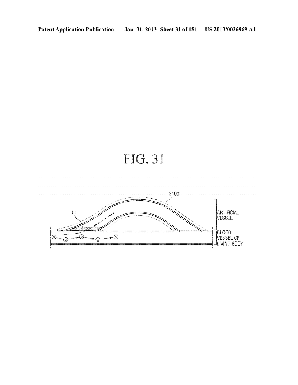 TUBE-STRUCTURED BATTERY TO BE INSERTED INTO LIVING BODY - diagram, schematic, and image 32