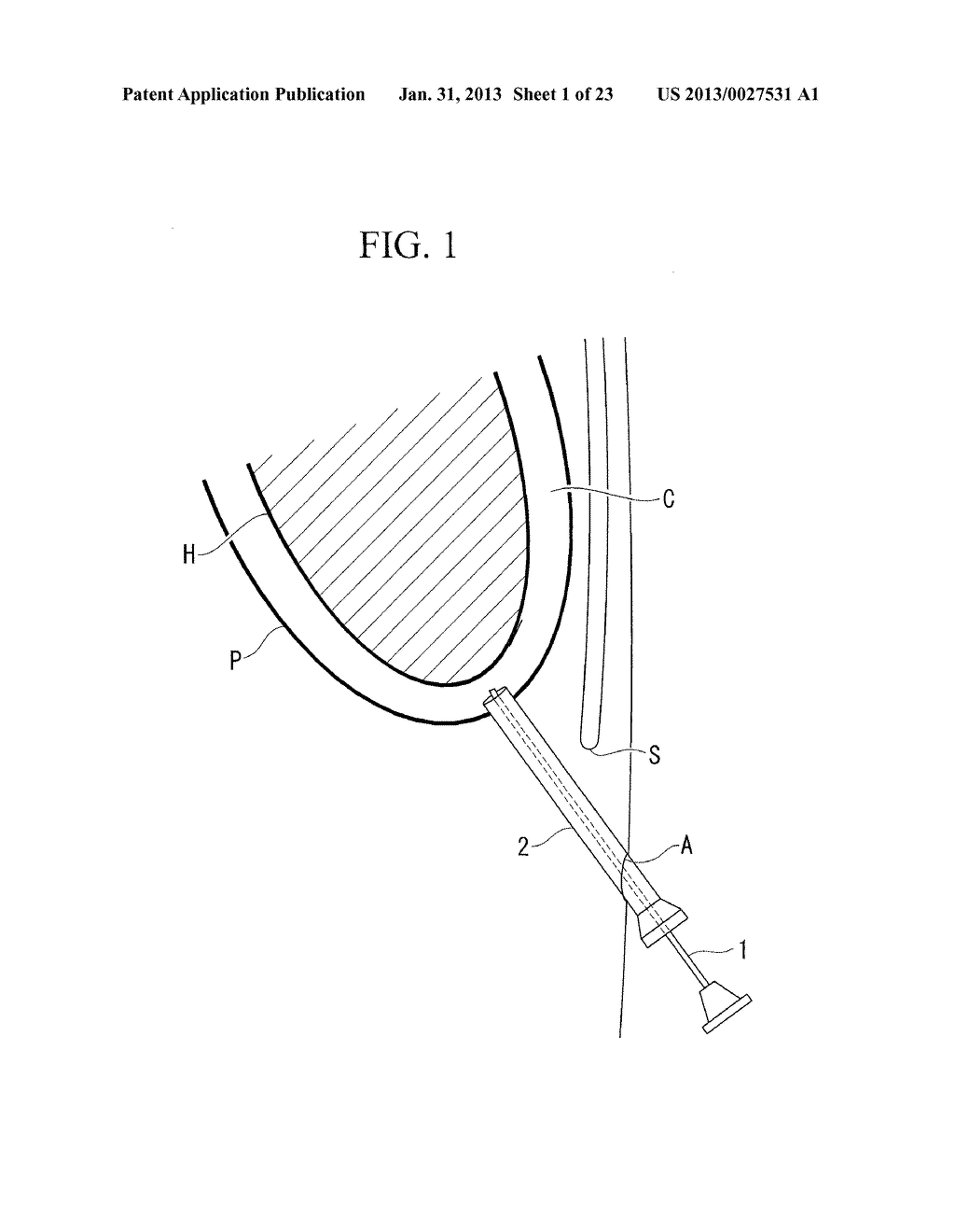 OPERATION METHOD OF ENDOSCOPE - diagram, schematic, and image 02