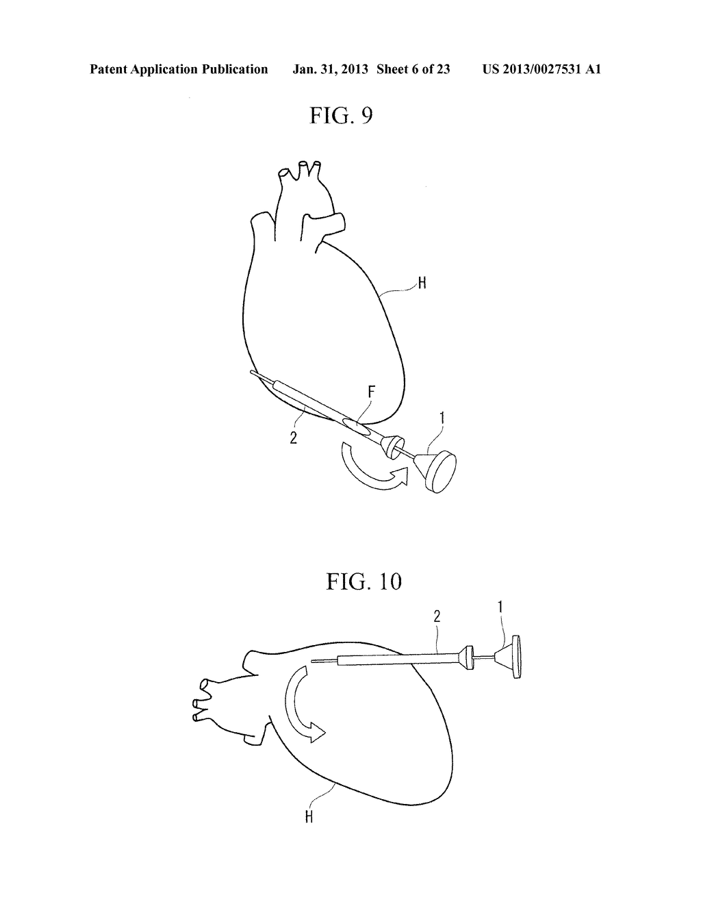 OPERATION METHOD OF ENDOSCOPE - diagram, schematic, and image 07