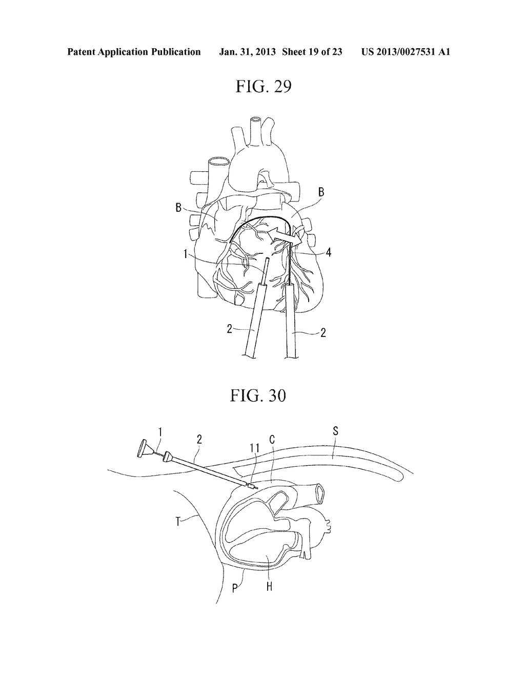 OPERATION METHOD OF ENDOSCOPE - diagram, schematic, and image 20