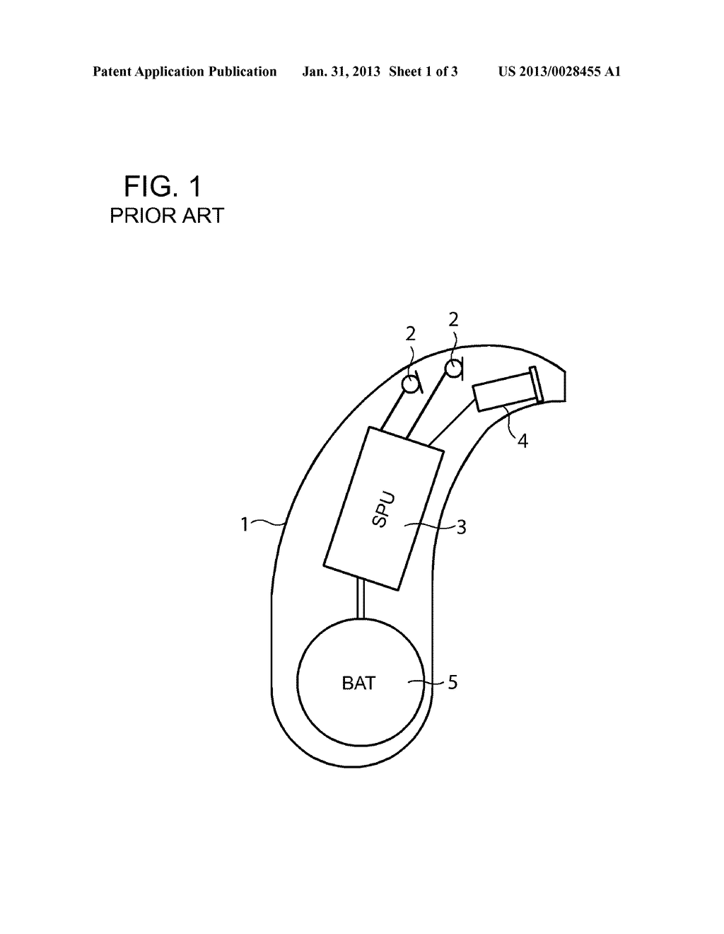 HEARING APPARATUS HAVING A SPECIAL SOUND CHANNEL - diagram, schematic, and image 02