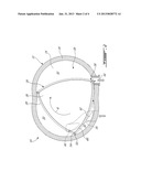 COMPOUND ENGINE SYSTEM WITH ROTARY ENGINE diagram and image