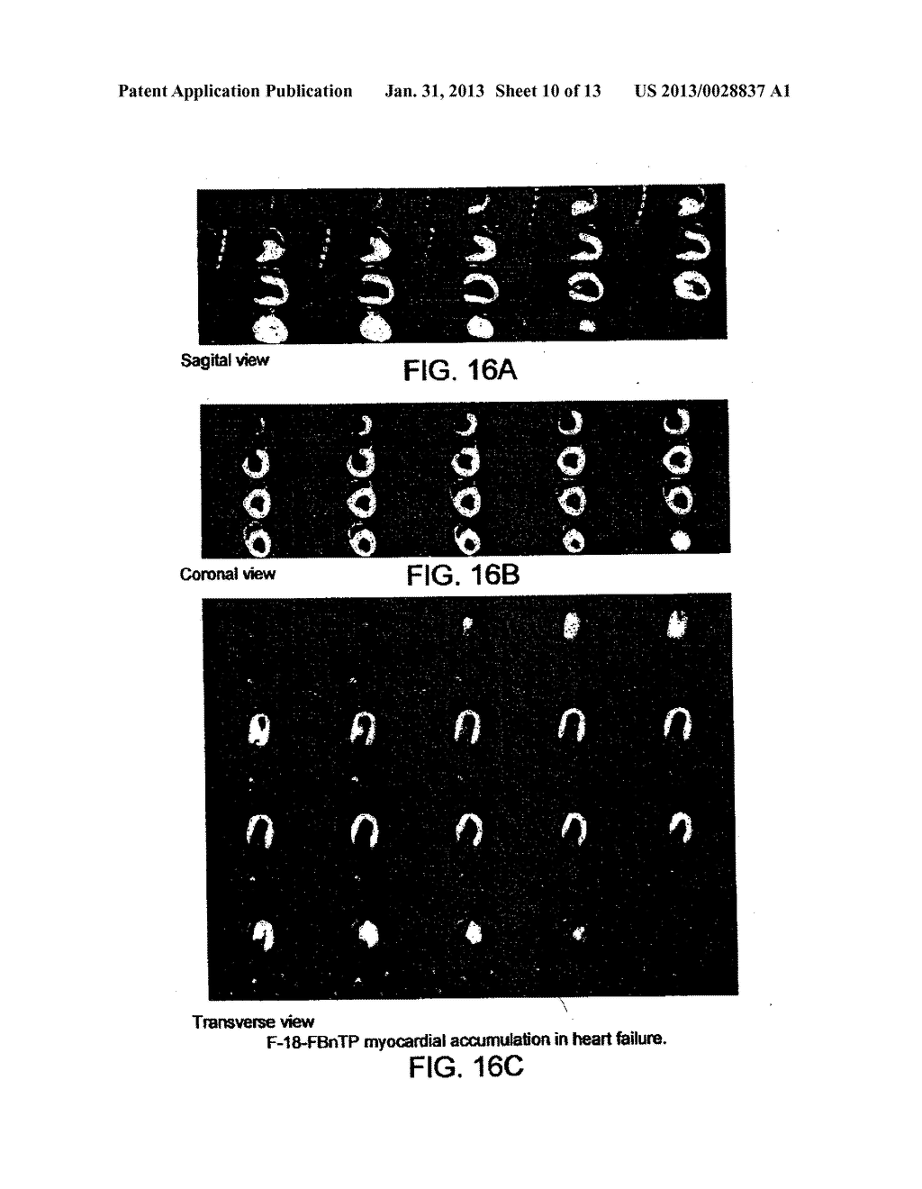 CONTRAST AGENTS FOR MYOCARDIAL PERFUSION IMAGING - diagram, schematic, and image 11