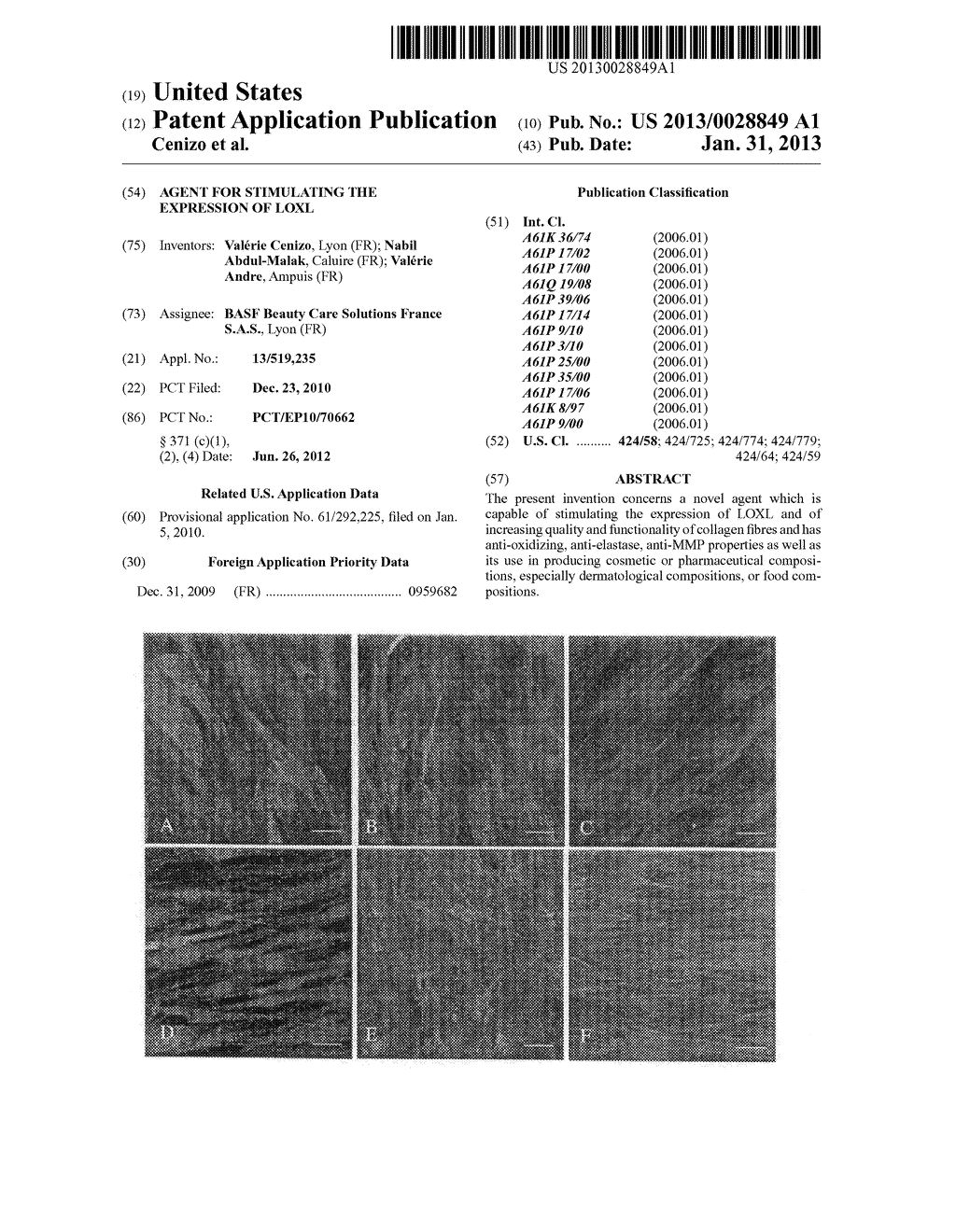 Agent For Stimulating The Expression of Loxl - diagram, schematic, and image 01