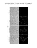 METHOD OF DIAGNOSING AND TREATING MELIOIDOSIS diagram and image