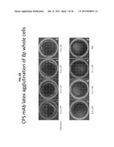 METHOD OF DIAGNOSING AND TREATING MELIOIDOSIS diagram and image