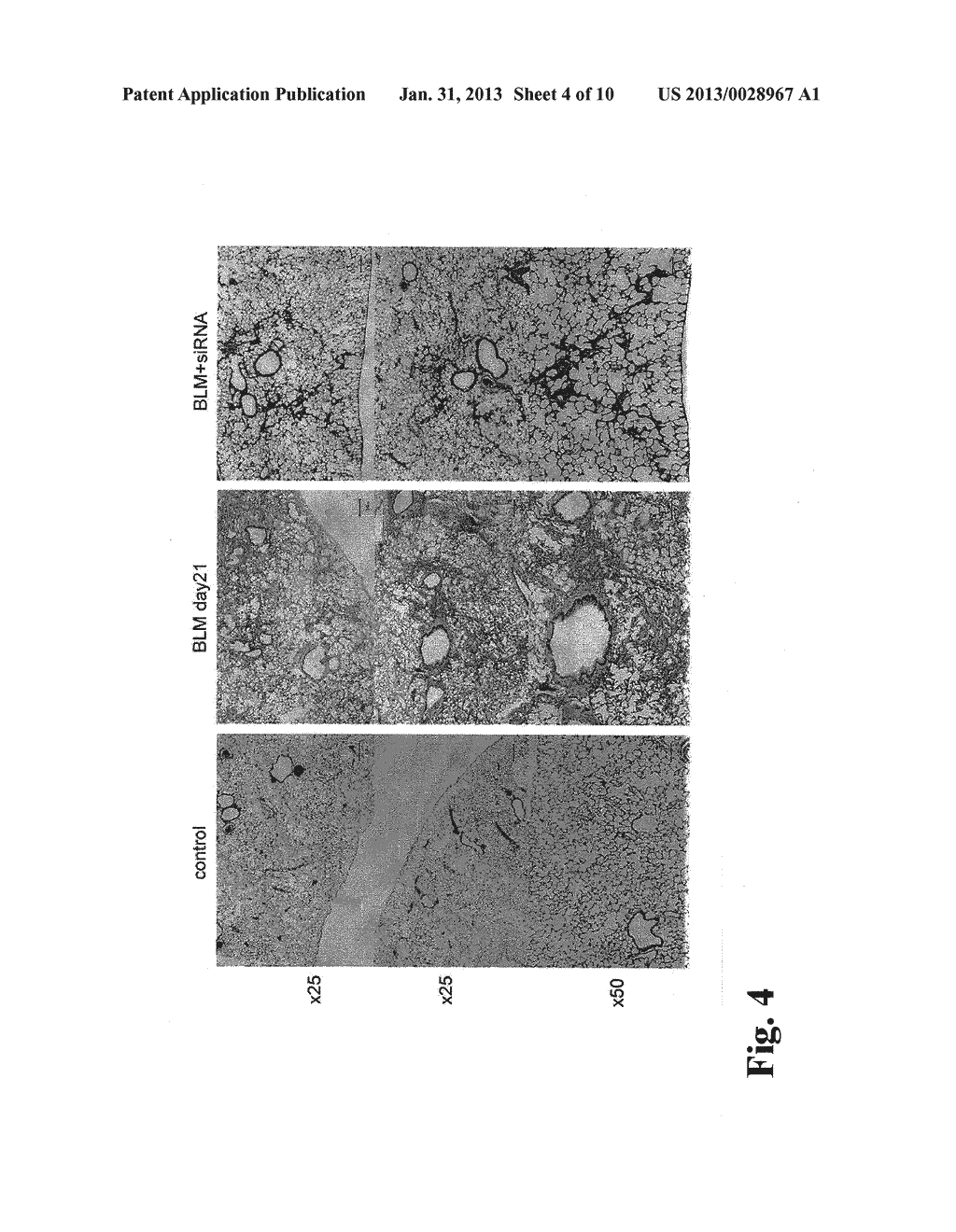 THERAPEUTIC AGENT FOR PULMONARY FIBROSIS - diagram, schematic, and image 05