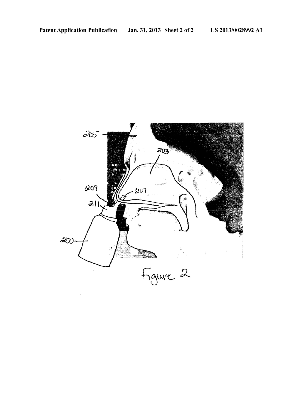 Herbal-Based Solution for Treating Symptoms of Nasal Conditions - diagram, schematic, and image 03